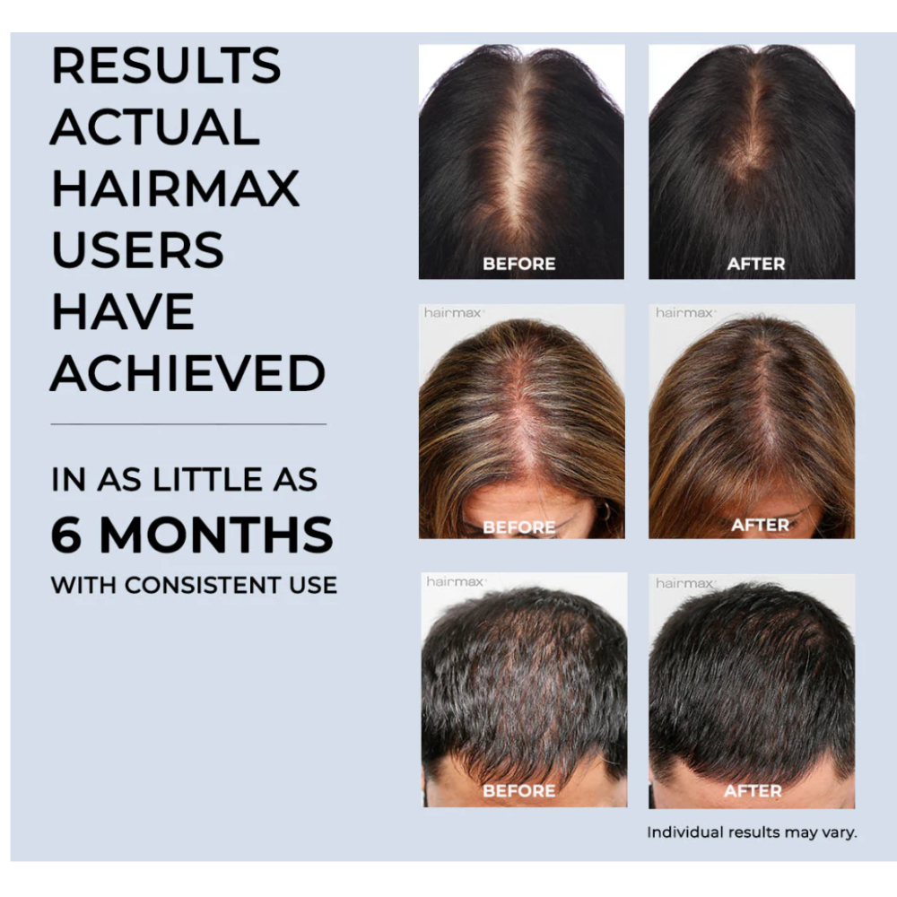 HairMax ACTONIS™ 18 DUAL ACTION LASERCOMB — Peigne laser double action (Actduo18)