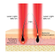 HairMax ACTONIS™ 18 DUAL ACTION LASERCOMB — Peigne laser double action (Actduo18)