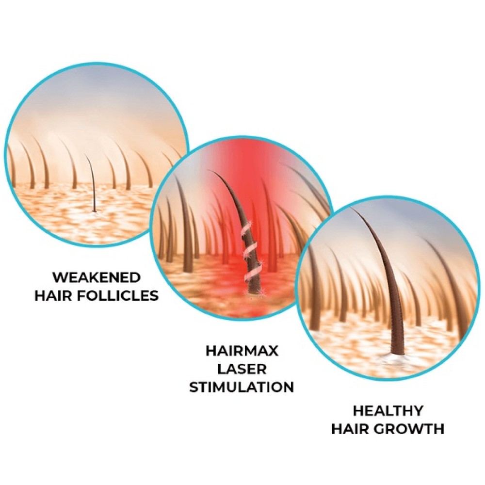 HairMax LaserBand 41 - ComfortFlex, bandeau-peigne laser (16960)
