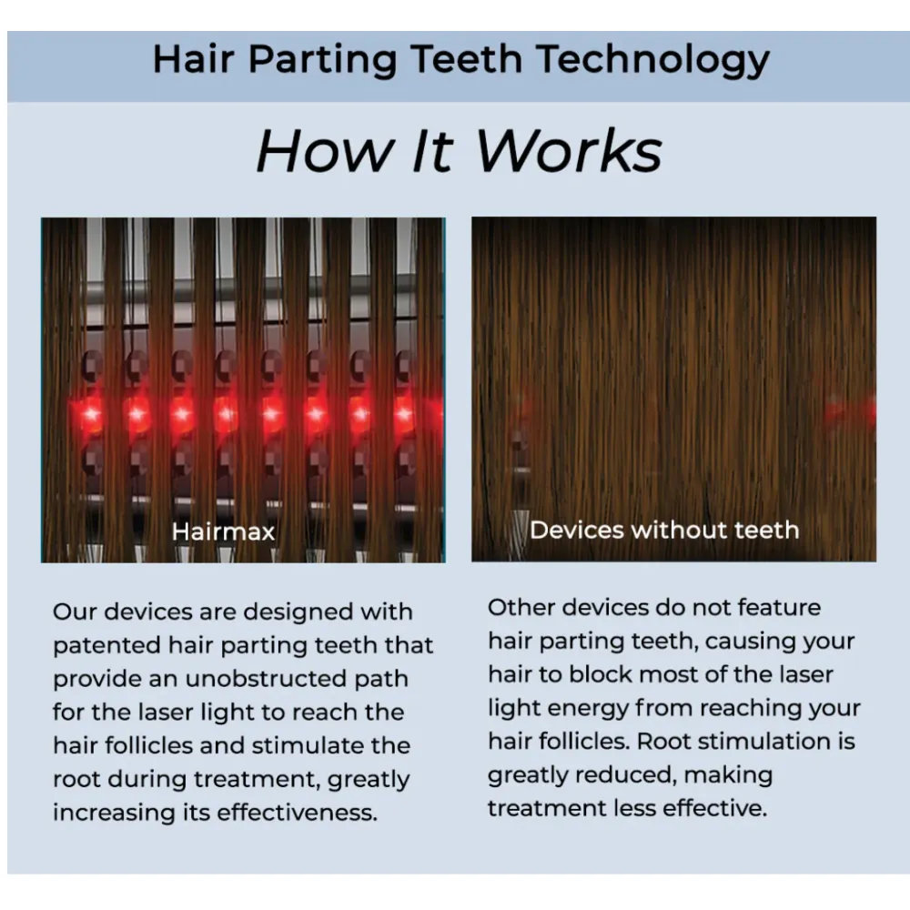 HairMax ACTONIS™ 18 DUAL ACTION LASERCOMB — Peigne laser double action