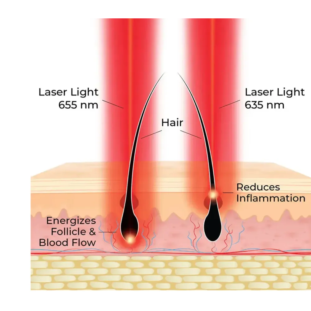 HairMax ACTONIS™ 18 DUAL ACTION LASERCOMB — Peigne laser double action