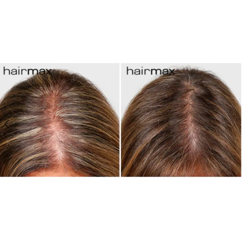 HairMax LaserBand 82 - ComfortFlex, bandeau peigne laser, or rose